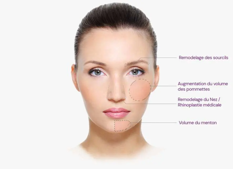 Remodelage du visage