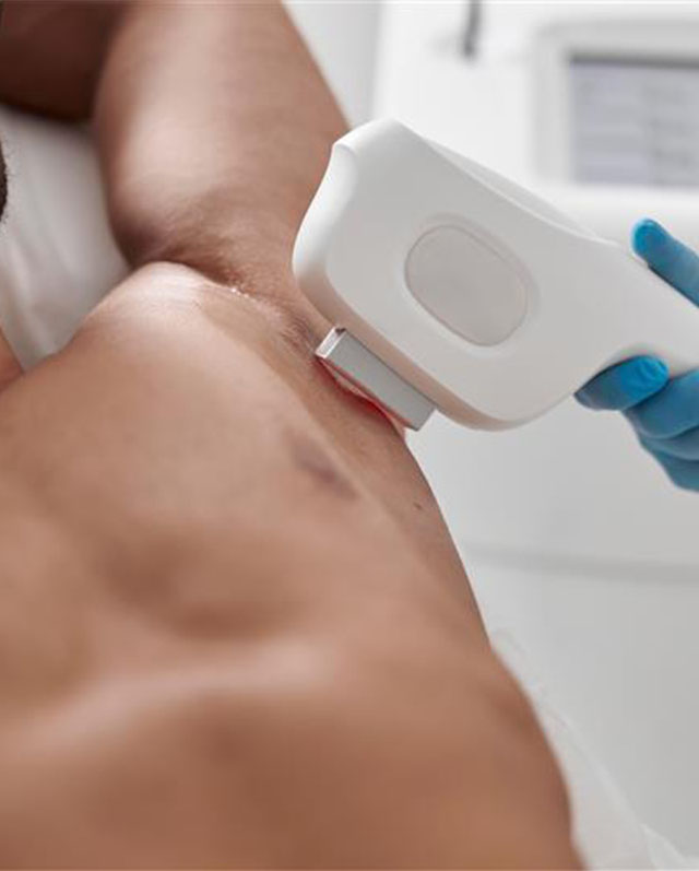 miniature_traitement_epil_homme_lazeo