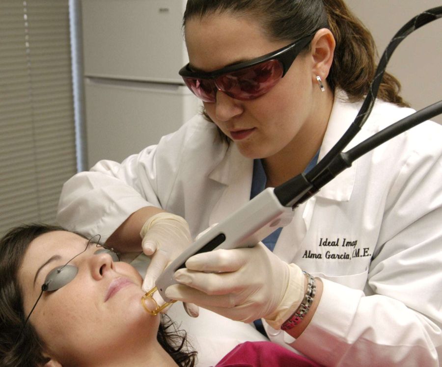 Qu’est-ce que l’épilation laser?