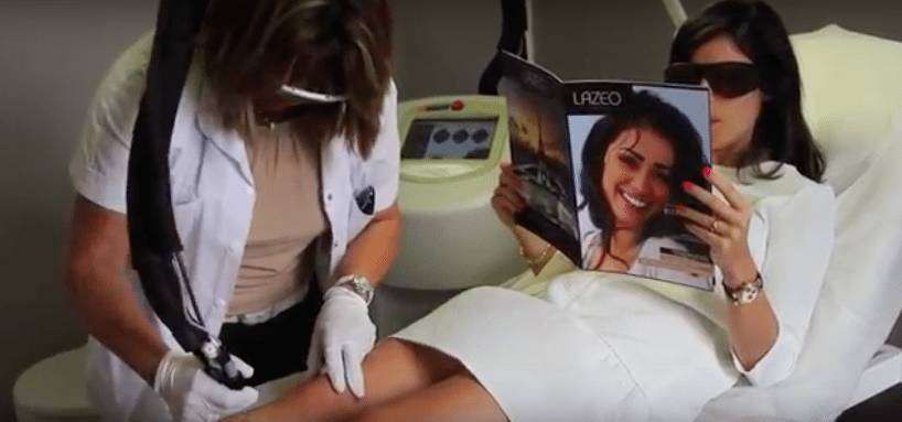 epilation laser